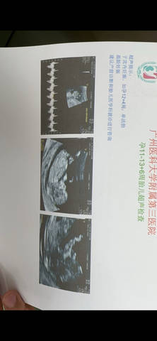 journal_insert_pic_4086618178