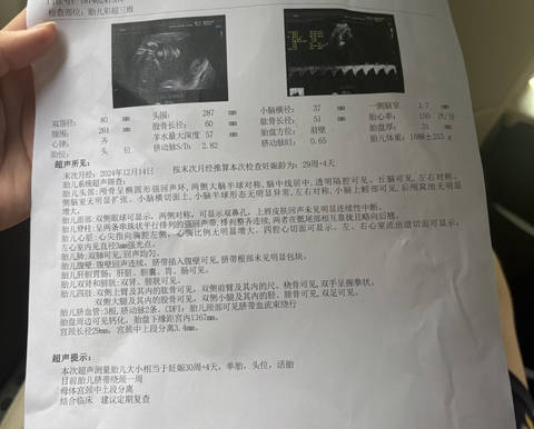 journal_insert_pic_4363064845