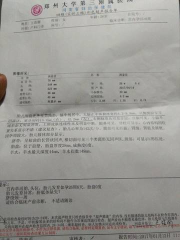 journal_insert_pic_1510221002